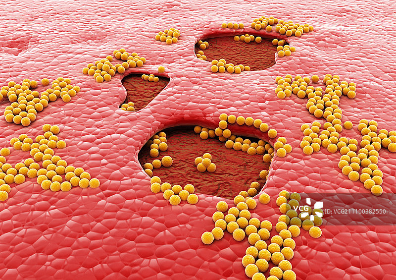 显微镜下的黄色细菌图片素材