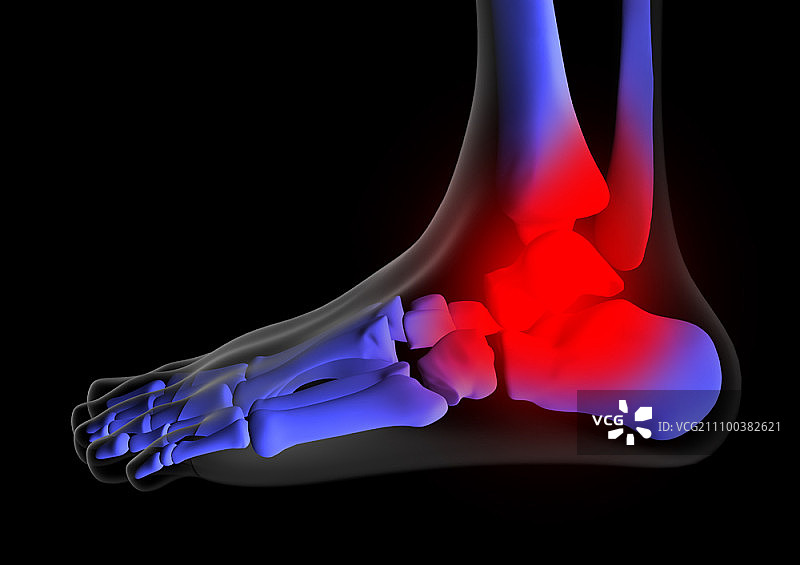 左脚X光片图片素材