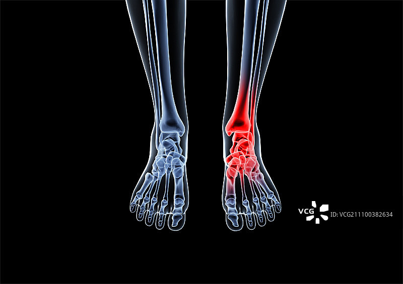 脚踝和足部的X光片图片素材