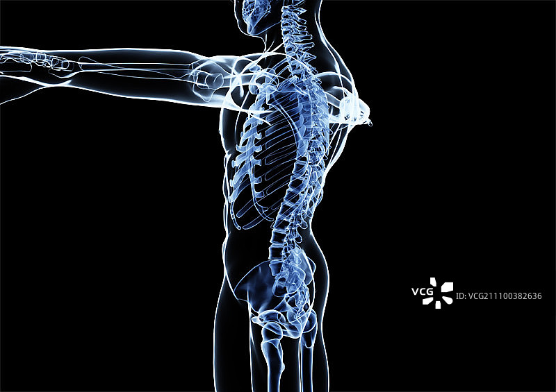 男子伸出左臂的侧视图X光片图片素材