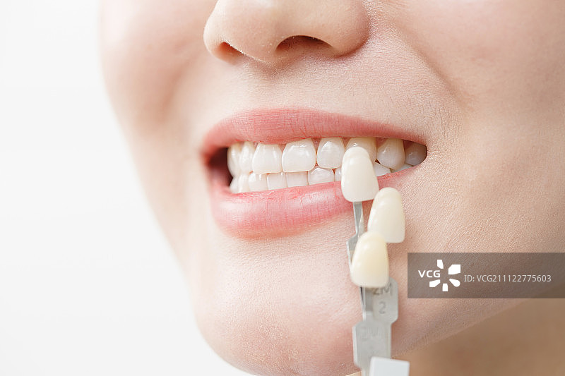 青年女人牙齿美容图片素材