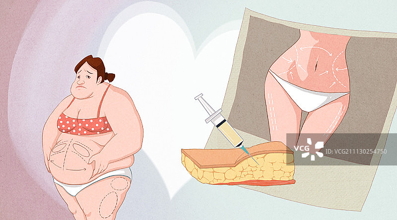 整容手术插画图片素材