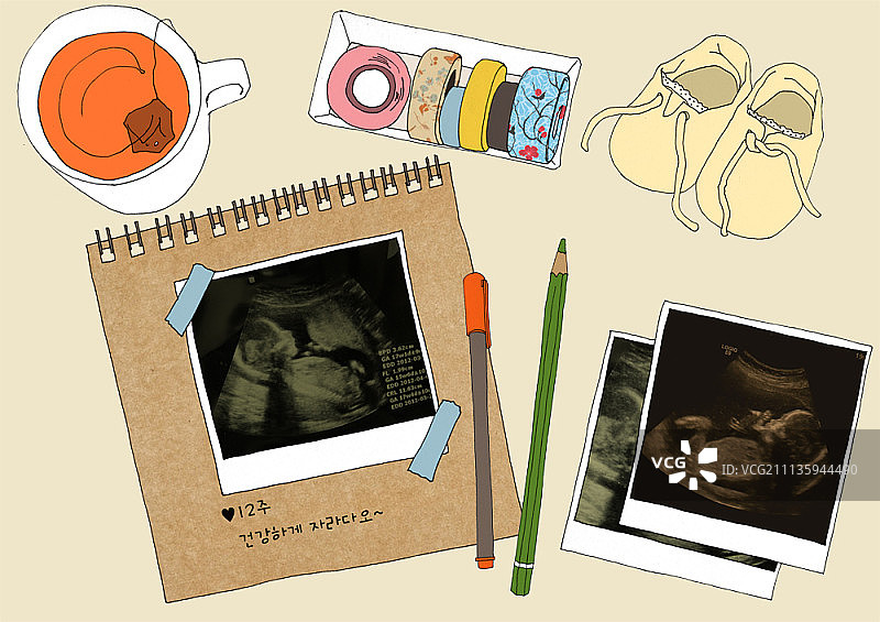 婴儿的声波图图片素材