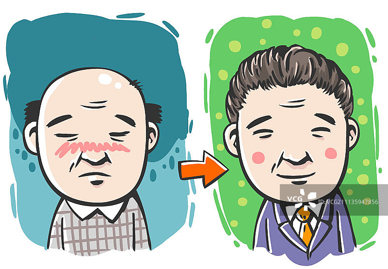 戴假发的秃头男人图片素材