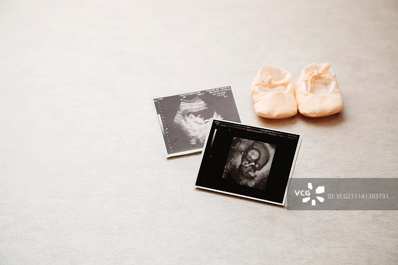 胎儿的超声波图像图片素材