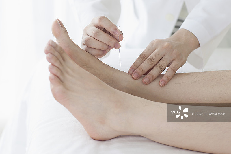 女性,针灸图片素材