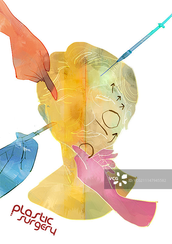 整形外科图示图片素材