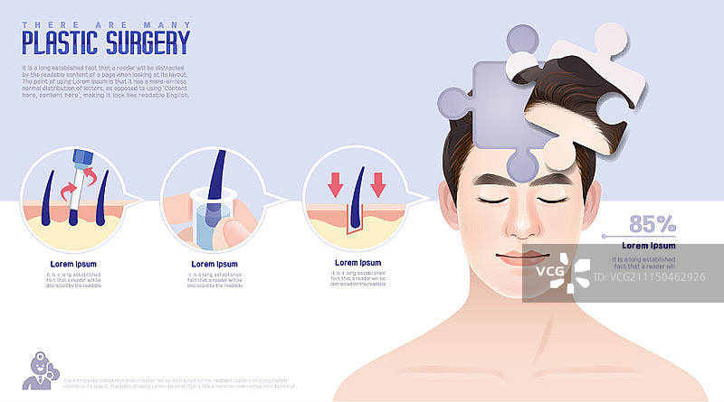 带有信息图元素的整形外科概念海报图片素材