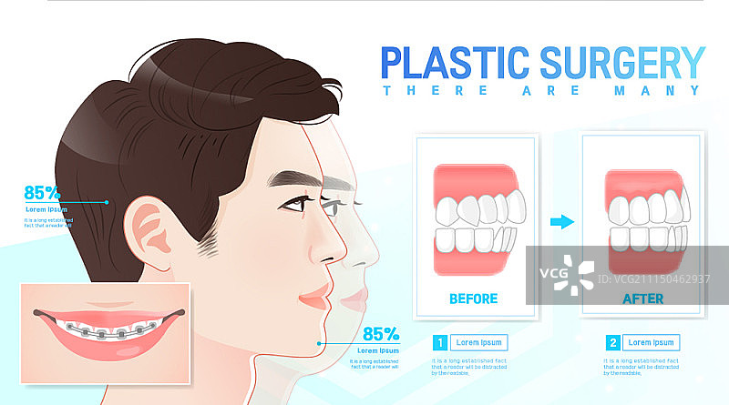 带有信息图元素的整形外科概念海报图片素材