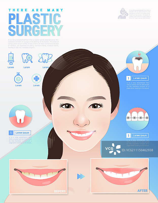 带有信息图元素的整形外科概念海报图片素材