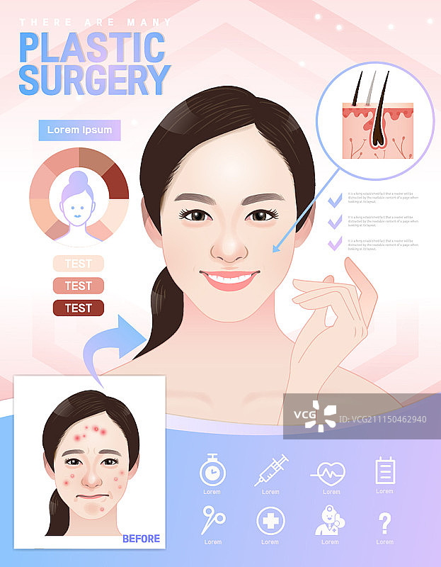 带有信息图元素的整形外科概念海报图片素材