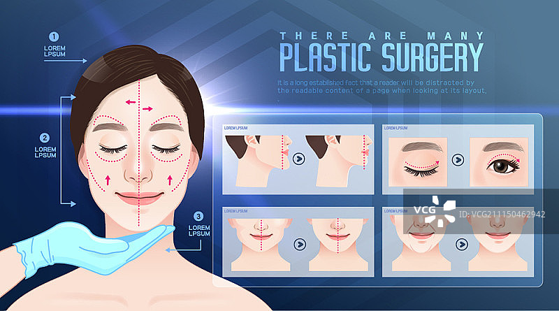 整形外科概念海报图片素材