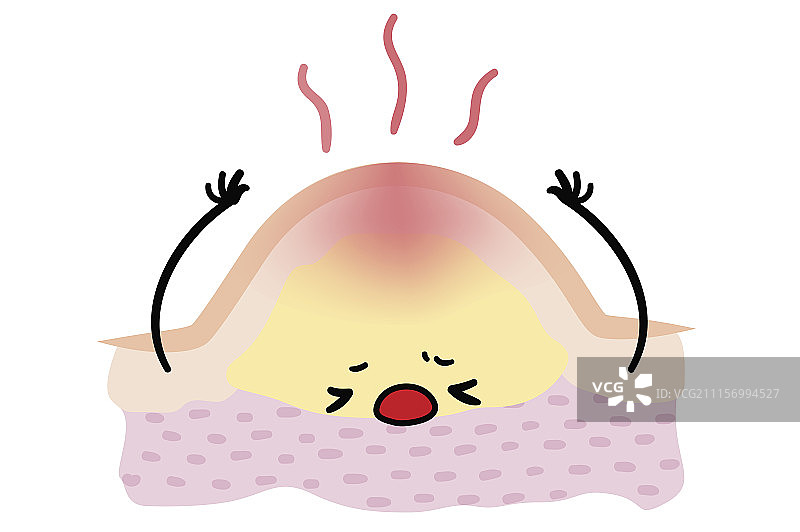 红肿的皮肤图片素材