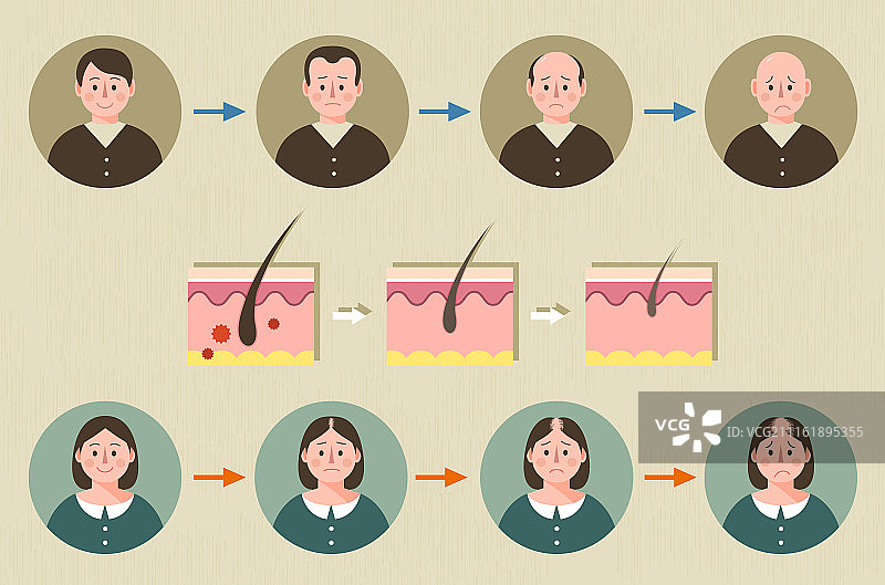 压力、脱发、疾病、药物图片素材