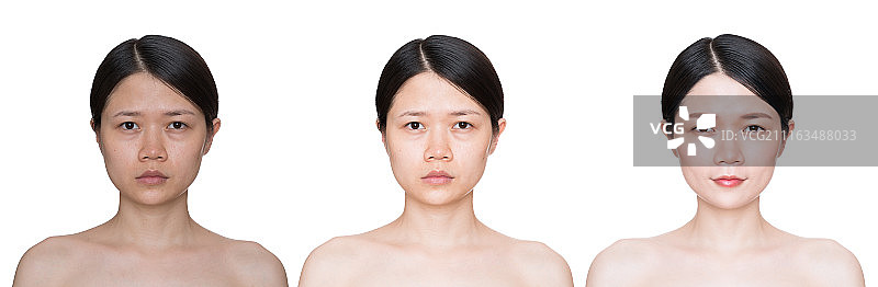 女人整容图片素材