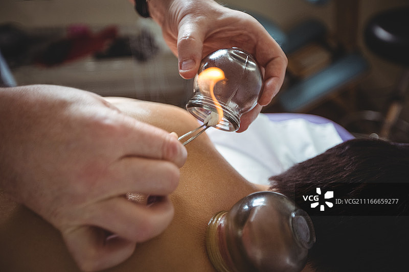理疗师为男士进行火罐疗法图片素材