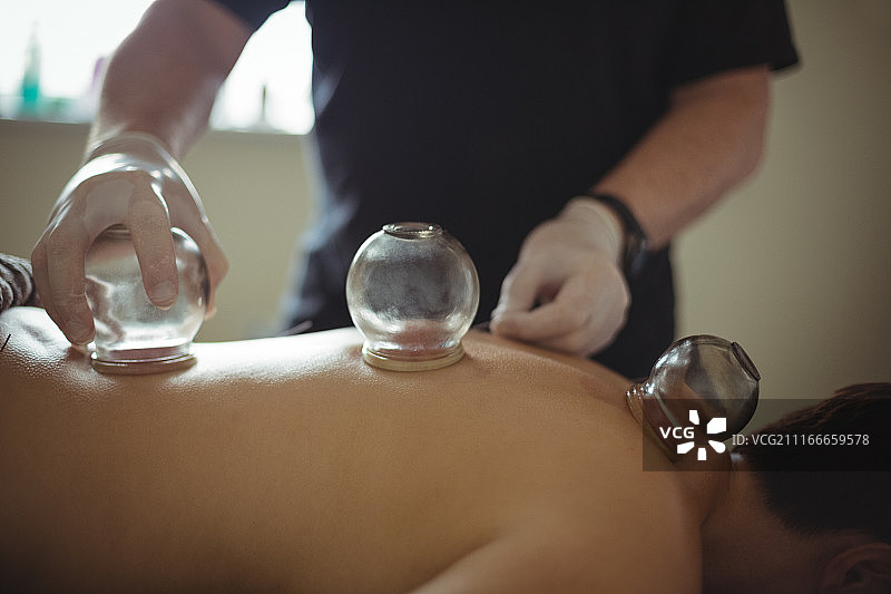 理疗师为男人进行拔罐疗法的腰部特写图片素材