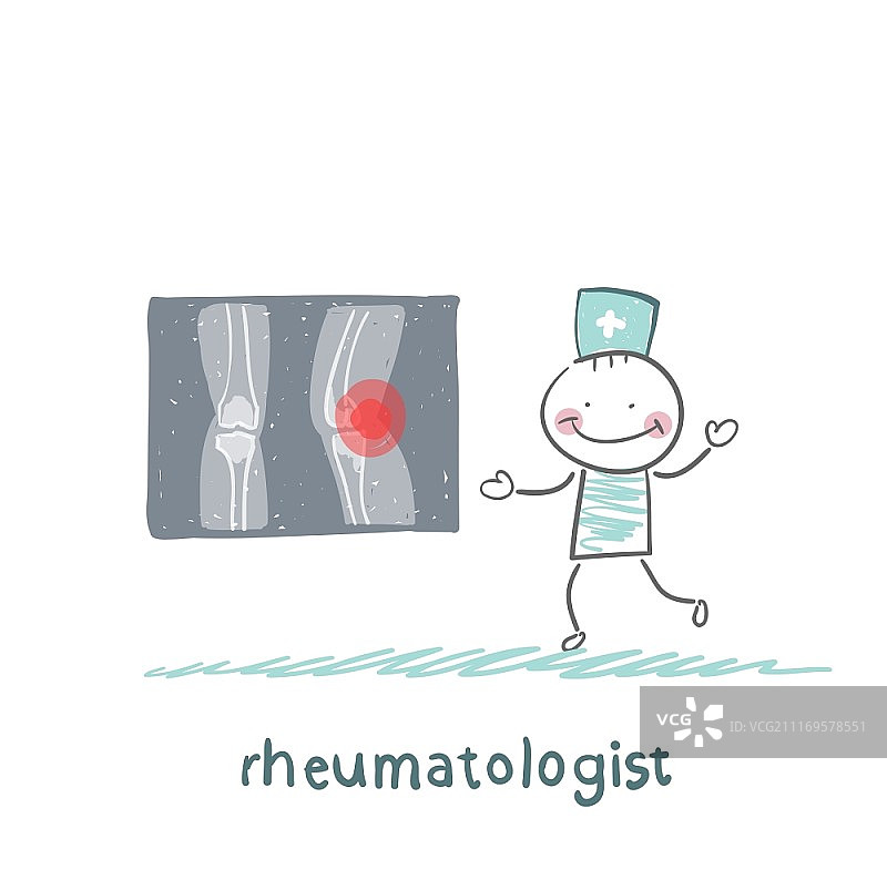 风湿病学家谈论脚关节疼痛并展示X光片图片素材