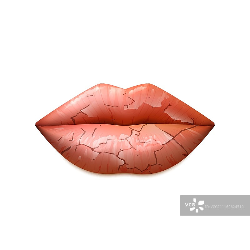 嘴唇干燥插画：经典造型的女性嘴唇干裂，逼真矢量图图片素材