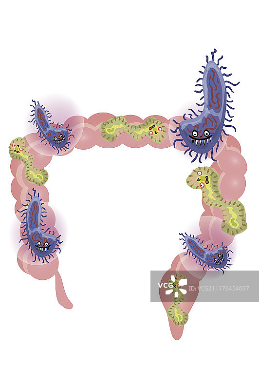 肠道,坏菌图片素材