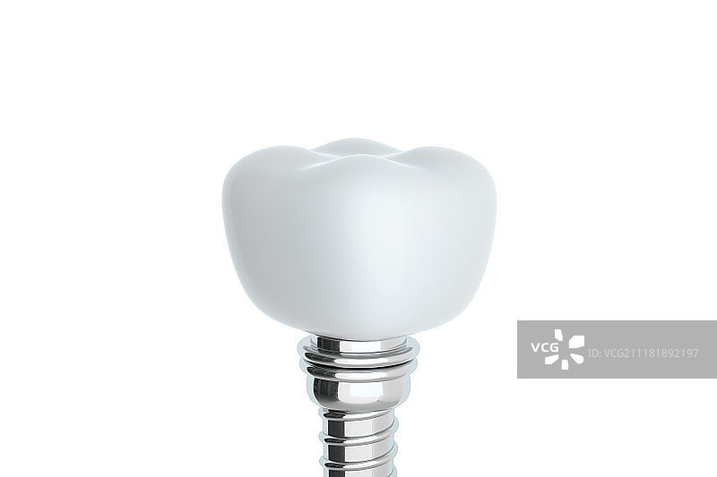 种植牙齿图片素材