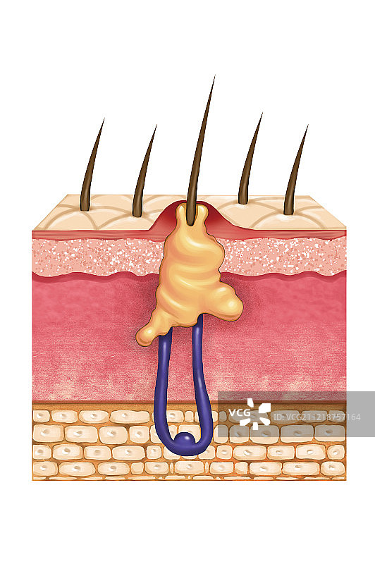 不健康的毛囊图片素材