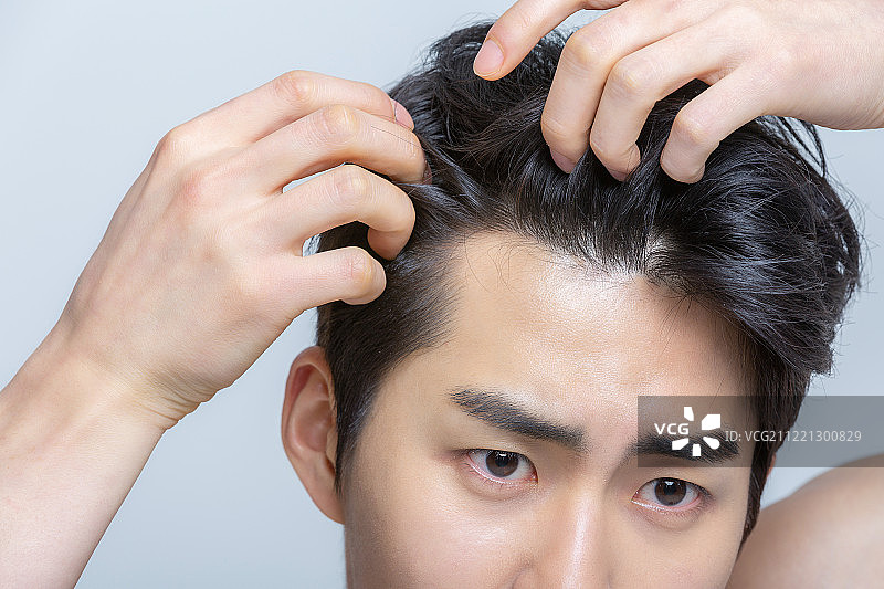 头发，脱发，头皮，头发护理，疾病，韩国人，亚洲人，压力图片素材