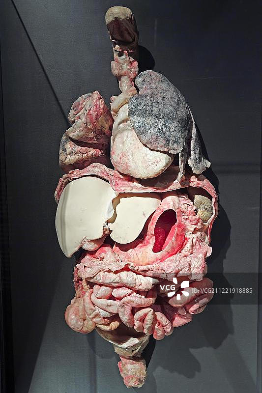 人体塑化标本，慢性阻塞性肺病内脏，人体世界展览，人类博物馆，德国柏林图片素材