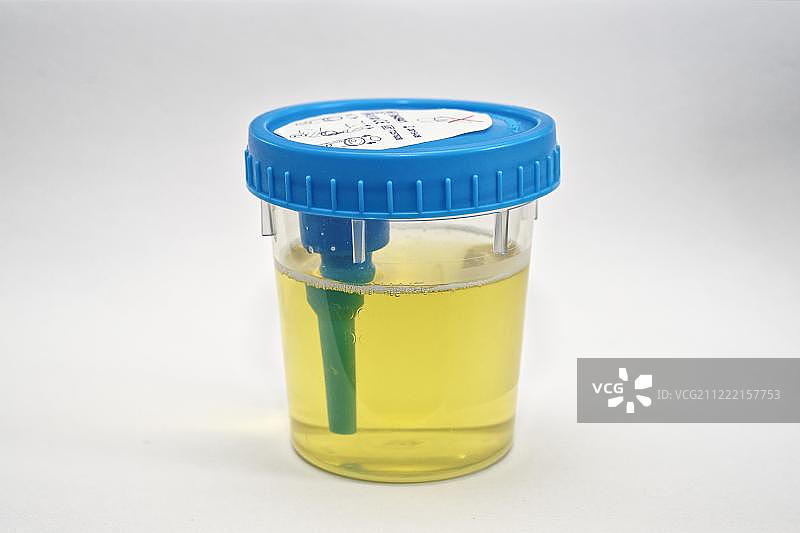 用于检查的烧杯中的尿液样本，瑞士，欧洲图片素材