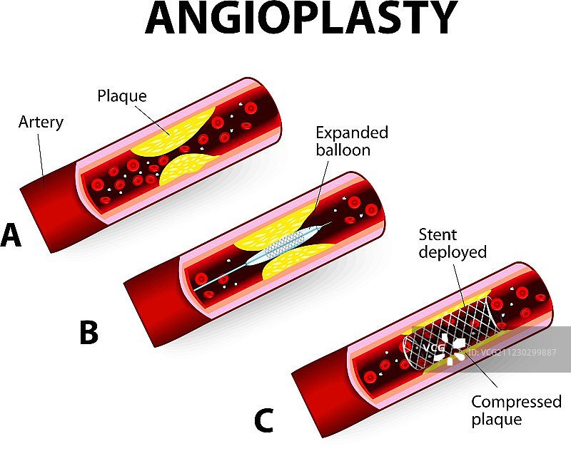 白色背景下的医疗设备特写图片素材