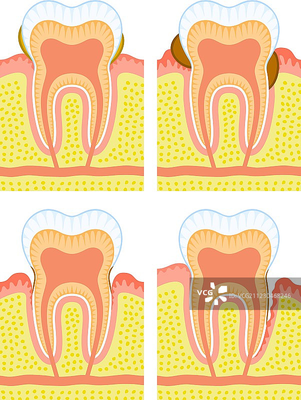 牙齿内部结构图片素材