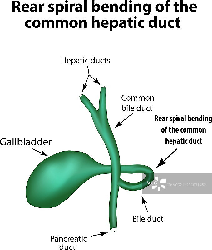 肝总管的后螺旋弯曲图片素材