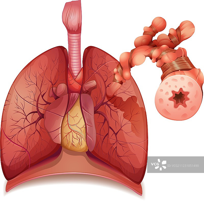 哮喘图片素材