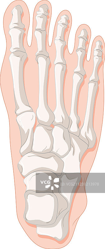 痛风脚趾骨骼X光片图片素材