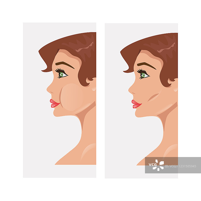 塑料颧骨图片素材