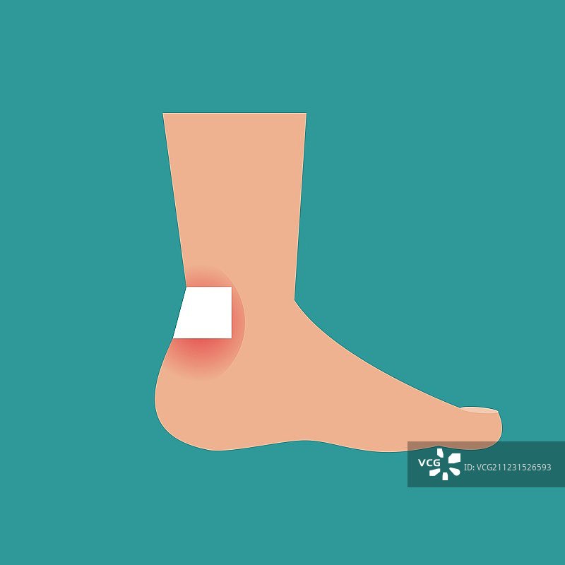 脚上的老茧图片素材