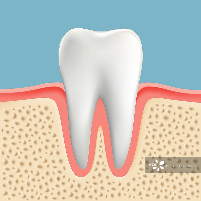 患有龋齿的人牙图片素材