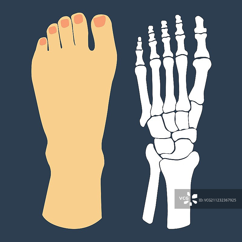 扁平足和足部骨骼设计图片素材