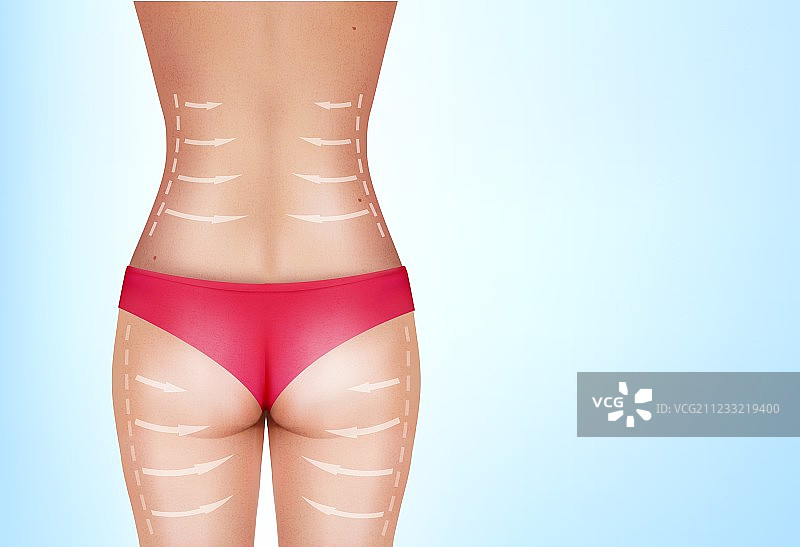 女性身体上的手术切线图片素材