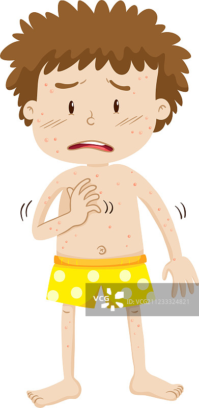 患有水痘的男孩图片素材