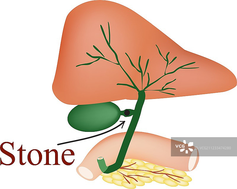 胆总管胆囊十二指肠胰腺图片素材