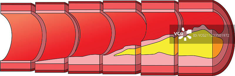 胆固醇图片素材
