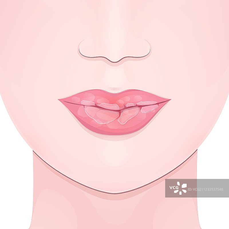 干燥的嘴唇图片素材