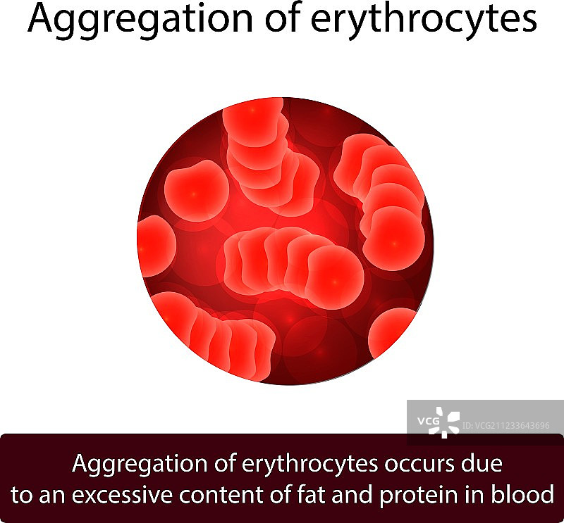 红细胞聚集图片素材