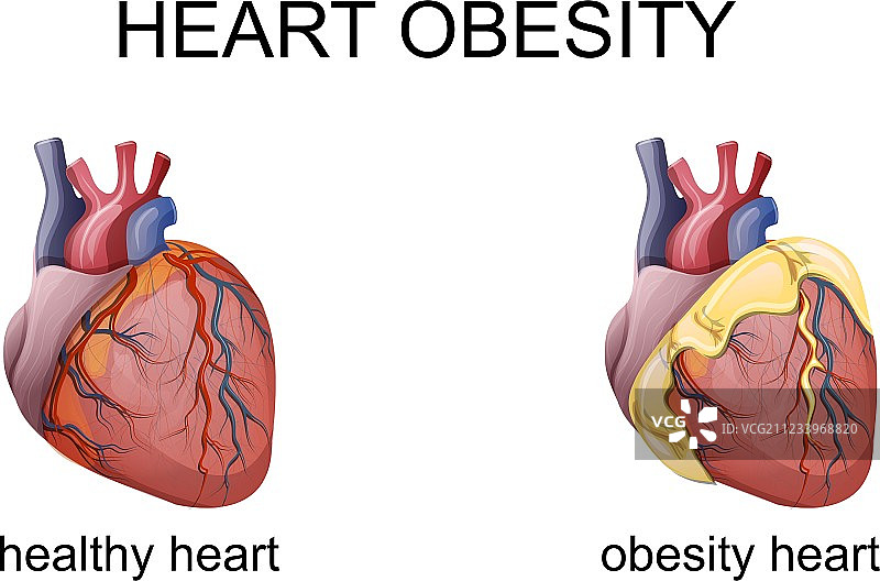 肥胖心脏图片素材