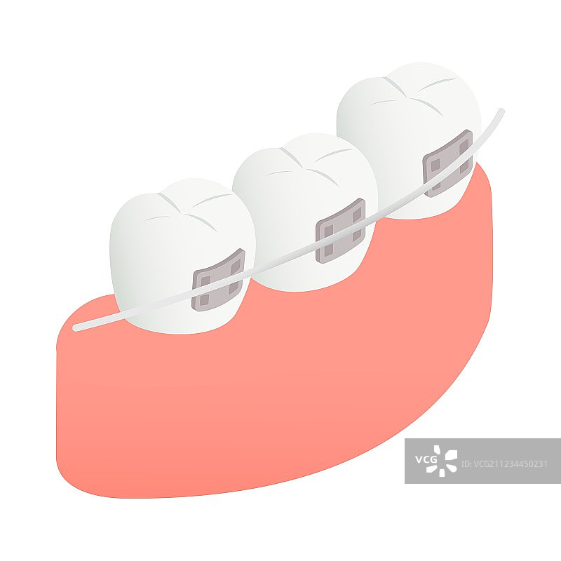 牙齿上的牙套等距3D风格图标图片素材