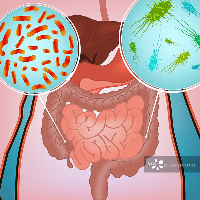 肠道感染图像图片素材
