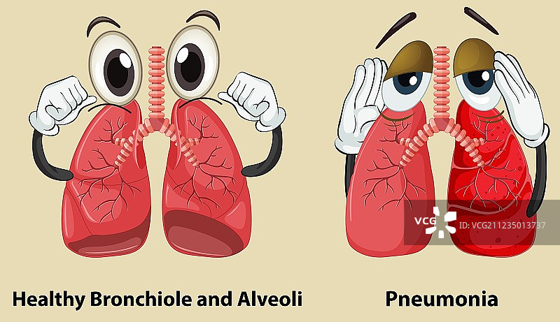 健康肺与肺炎肺部图解图片素材