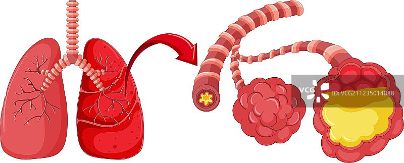 患有肺炎的人类肺部图片素材