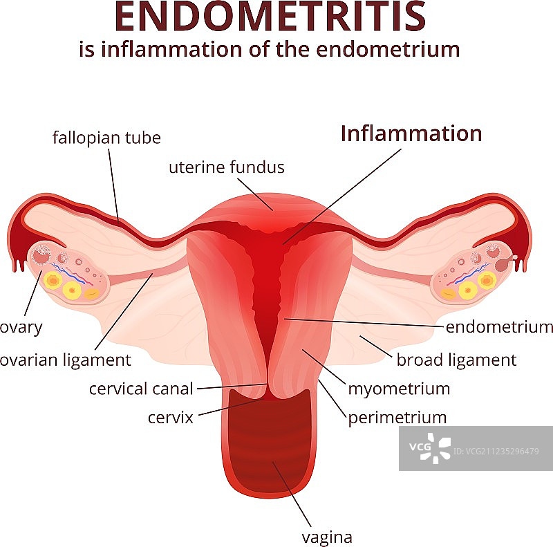 女性生殖系统图片素材